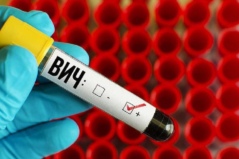 За 2019 год в Могилевской области выявлено 203 новых случая ВИЧ-инфекции