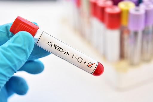 Обращаться к врачам нужно своевременно - болеющая COVID-19 витебчанка